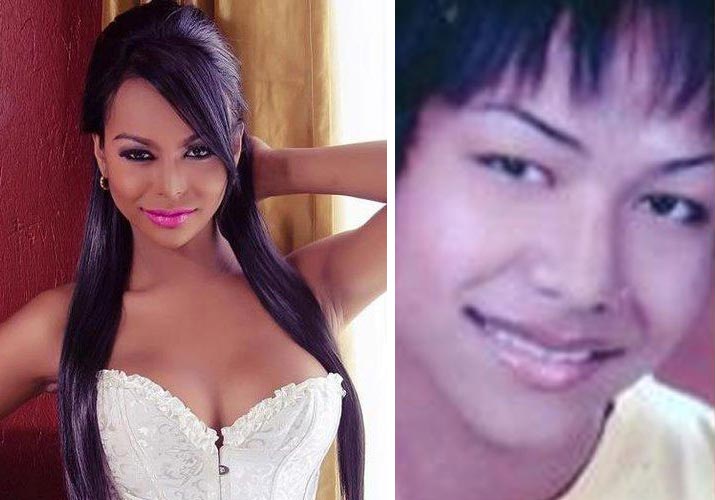 Fiona Solis antes e depois